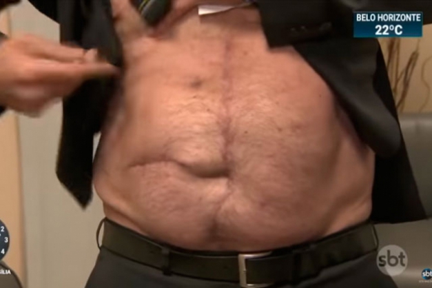 Bolsonaro mostra a cicatriz na barriga Macaque in the trees