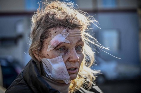 Foto: Aris Messinis/AFP