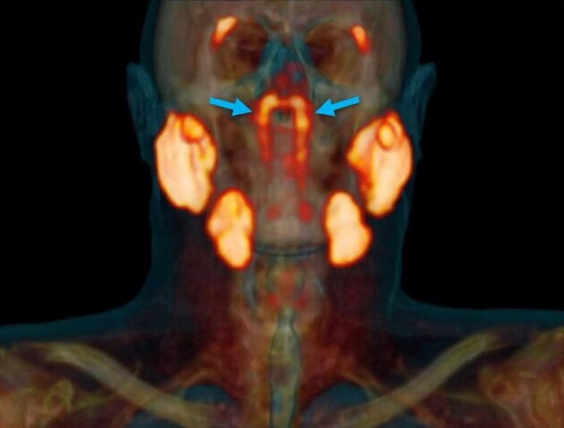 Foto: Radiotherapy and Oncology