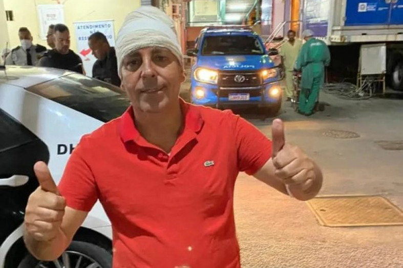Parlamentar foi baleado de raspão em 2020 Macaque in the trees